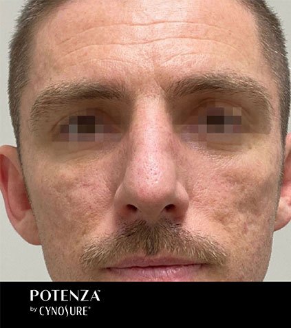 Potenza-BA-041-A