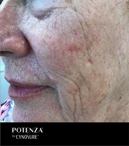 potenza-2-a potenza-2-a